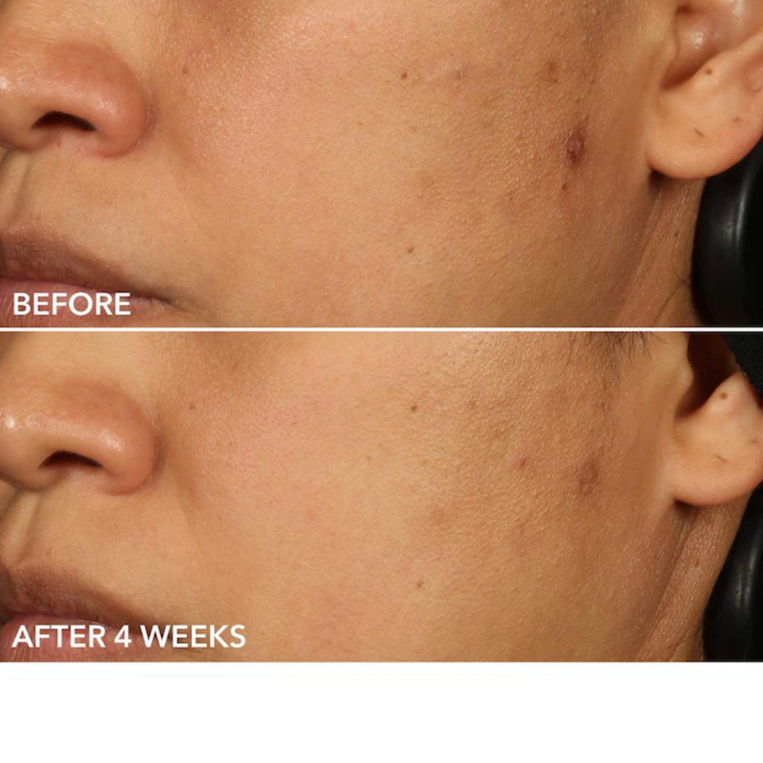 ADVANCED RETINOL + FERULIC PERFECTLY DOSED RETINOL EXTRA STRENGTH 0.5% (ALMOHADILLAS EXFOLIANTES CON RETINOL)